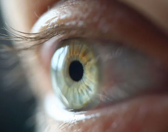 Tutkijoiden kehittämä piilolinssi annostelisi glaukoomalääkkeen automaattisesti.
