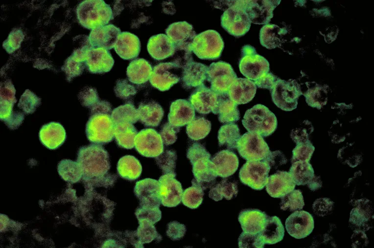 Mikroskooppikuvassa Naegleria fowleri -soluja.