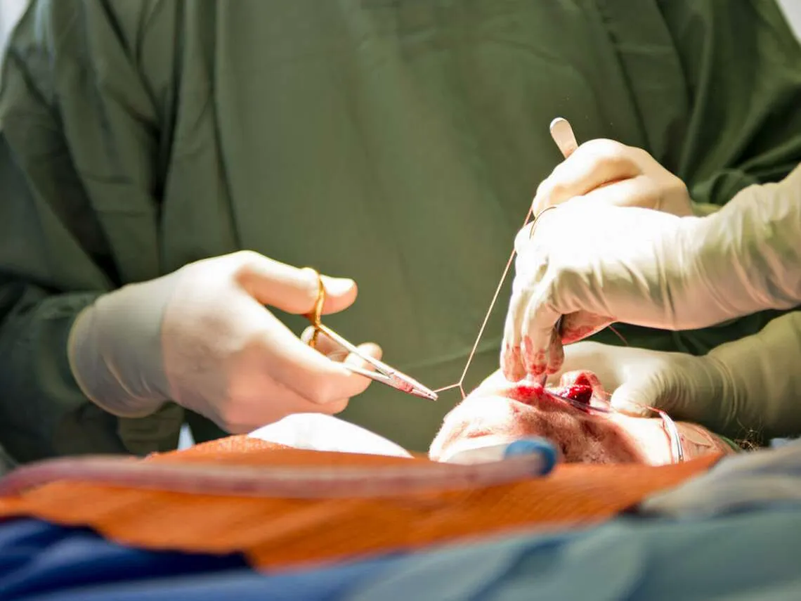 Tutkimus: Lähes kaikki kirurgit kuuntelevat musiikkia leikkaussalissa –  nämä artistit rytmittävät operaatioita | Kauppalehti