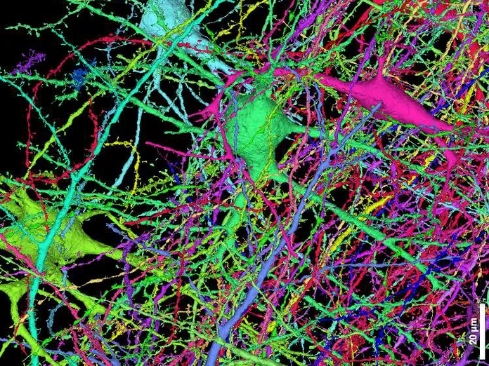 Ennätystarkka 3d-kartta aivonäytteestä: 1 400 000 gigatavua dataa vapaasti  katsottavissa – 