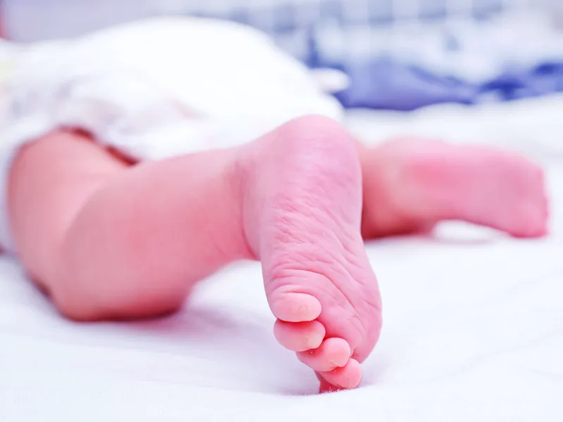 Syntyvyys Suomessa jatkoi laskuaan tammi-heinäkuussa, jolloin syntyi 1 154 lasta vähemmän kuin vuotta aiemmin.